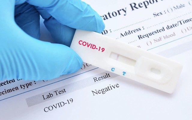 LABORATÓRIUMI ÉRTELMEZÉSI NEHÉZSÉGEK A COVID-19 DIAGNOSZTIKÁJÁBAN