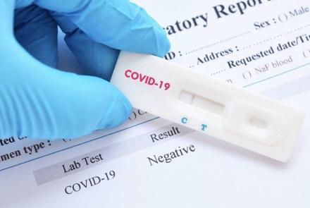LABORATÓRIUMI ÉRTELMEZÉSI NEHÉZSÉGEK A COVID-19 DIAGNOSZTIKÁJÁBAN